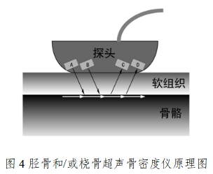 超聲骨密度儀注冊(cè)技術(shù)審查指導(dǎo)原則(2017年第180號(hào))(圖4) 超聲骨密度儀注冊(cè)技術(shù)審查指導(dǎo)原則(2017年第180號(hào))(圖4)