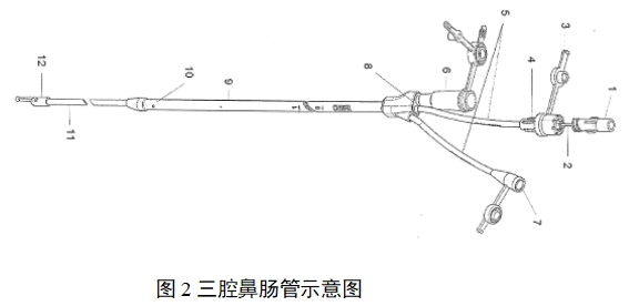 經(jīng)鼻腸營(yíng)養(yǎng)導(dǎo)管注冊(cè)審查指導(dǎo)原則(2022年第41號(hào))(圖2) 經(jīng)鼻腸營(yíng)養(yǎng)導(dǎo)管注冊(cè)審查指導(dǎo)原則(2022年第41號(hào))(圖2)