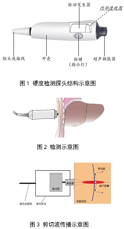 定量剪切波超聲肝臟測量儀注冊審查指導原則(2023年第7號)(圖2) 定量剪切波超聲肝臟測量儀注冊審查指導原則(2023年第7號)(圖2)