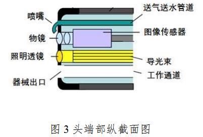 電子上消化道內(nèi)窺鏡注冊(cè)技術(shù)審查指導(dǎo)原則(2020年第87號(hào))(圖3) 電子上消化道內(nèi)窺鏡注冊(cè)技術(shù)審查指導(dǎo)原則(2020年第87號(hào))(圖3)